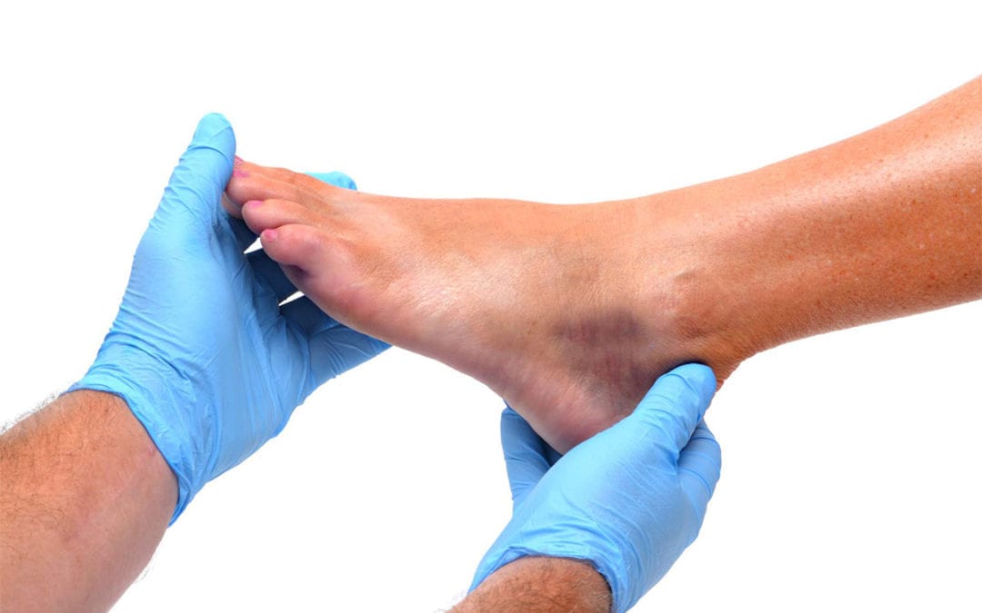 Best Practices for Preventing an Ankle Sprain