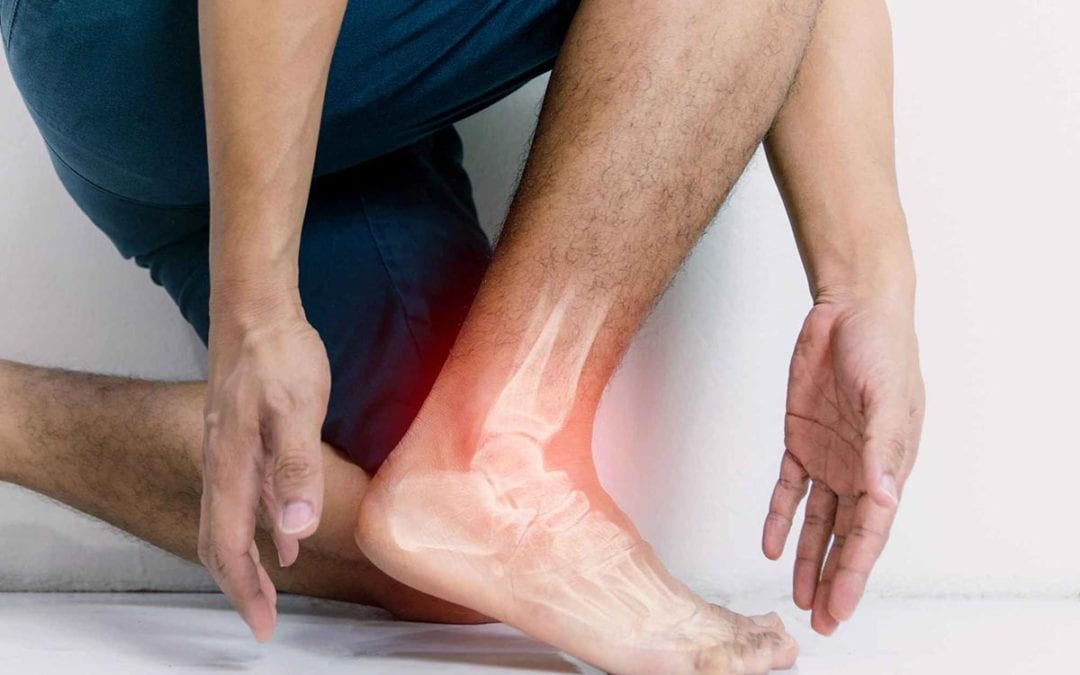 Ankle Arthroscopic Surgery: Treatment and Recovery