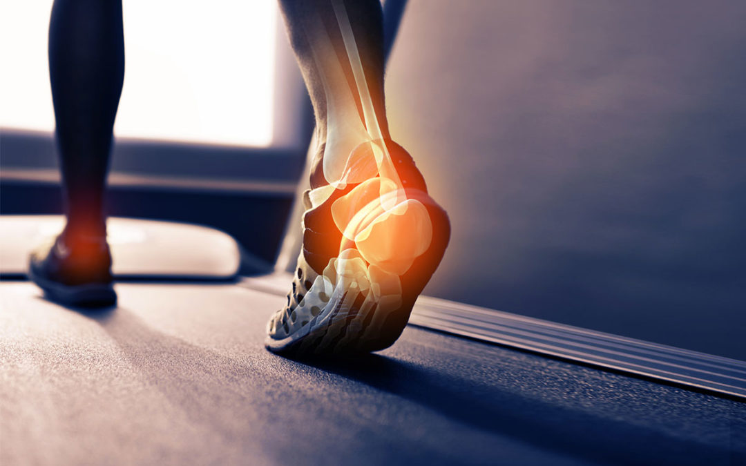 Prevent orthopedic injuries by choosing the right shoes